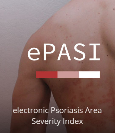 epasi