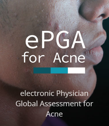 epgaacne